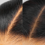 hd lace wig vs skin lace wig